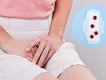 Nguyên nhân dùng băng vệ sinh bị dị ứng và cách xử lý hiệu quả